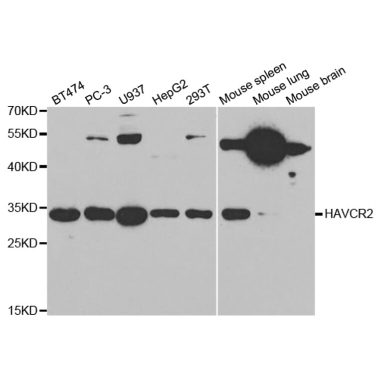 Western blot - HAVCR2 Antibody from Signalway Antibody (32686) - Antibodies.com