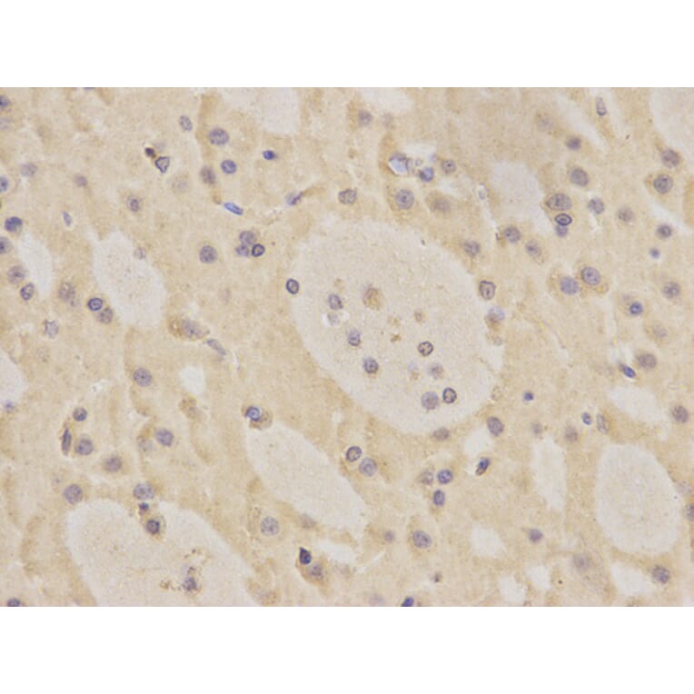 Immunohistochemistry - MRE11A Antibody from Signalway Antibody (32712) - Antibodies.com