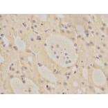 Immunohistochemistry - MRE11A Antibody from Signalway Antibody (32712) - Antibodies.com