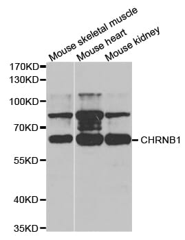 Western blot analysis of extracts of various cell lines, using RAD51 antibody.
