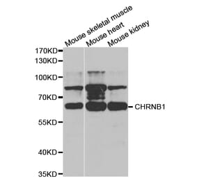 Western blot - CHRNB1 Antibody from Signalway Antibody (32749) - Antibodies.com