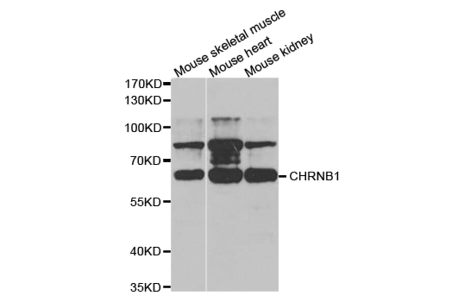 Western blot - CHRNB1 Antibody from Signalway Antibody (32749) - Antibodies.com