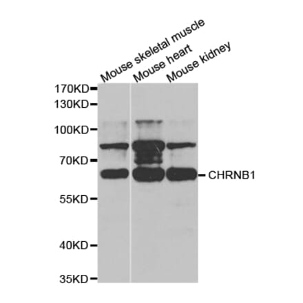 Western blot - CHRNB1 Antibody from Signalway Antibody (32749) - Antibodies.com