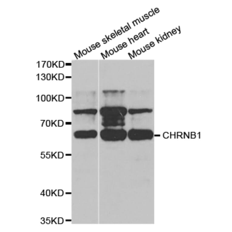 Western blot - CHRNB1 Antibody from Signalway Antibody (32749) - Antibodies.com