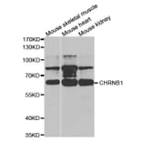 Western blot - CHRNB1 Antibody from Signalway Antibody (32749) - Antibodies.com