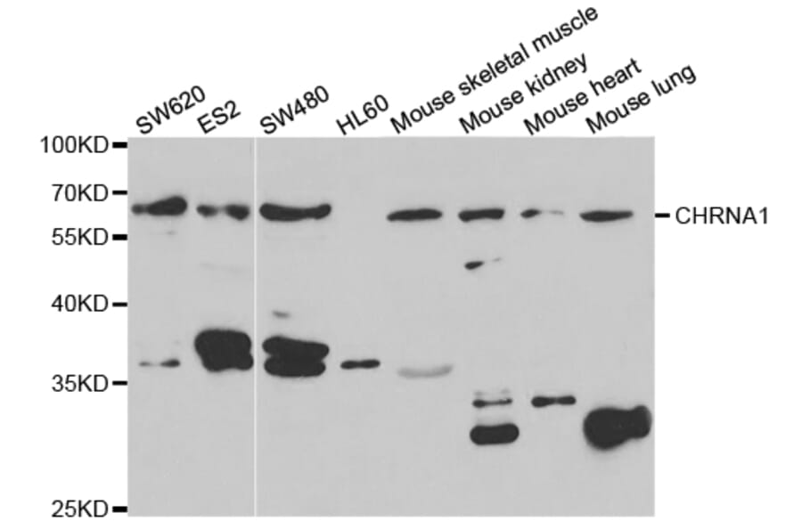 Western blot - CHRNA1 Antibody from Signalway Antibody (32760) - Antibodies.com