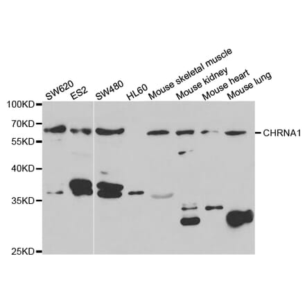 Western blot - CHRNA1 Antibody from Signalway Antibody (32760) - Antibodies.com