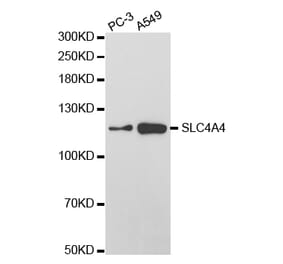 Western blot - SLC4A4 Antibody from Signalway Antibody (32777) - Antibodies.com