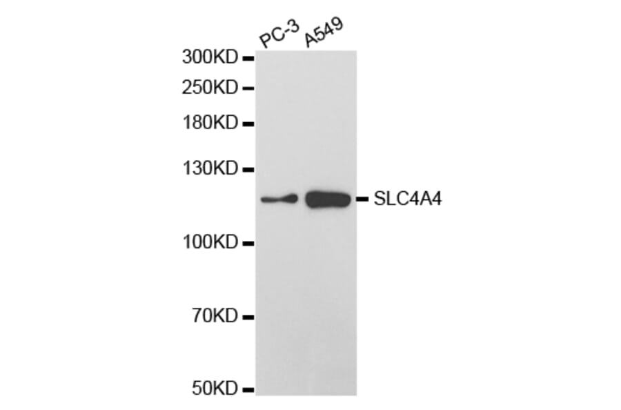 Western blot - SLC4A4 Antibody from Signalway Antibody (32777) - Antibodies.com