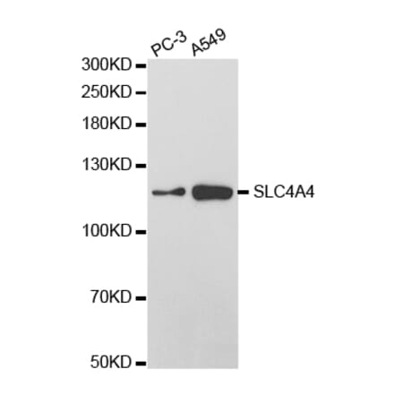 Western blot - SLC4A4 Antibody from Signalway Antibody (32777) - Antibodies.com