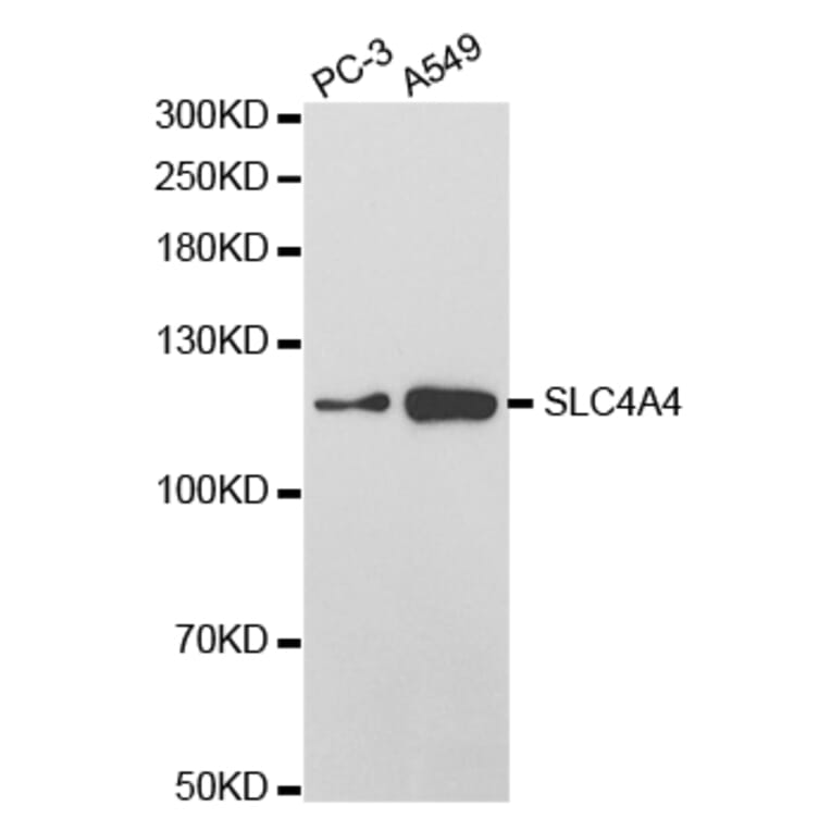 Western blot - SLC4A4 Antibody from Signalway Antibody (32777) - Antibodies.com