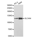 Western blot - SLC4A4 Antibody from Signalway Antibody (32777) - Antibodies.com
