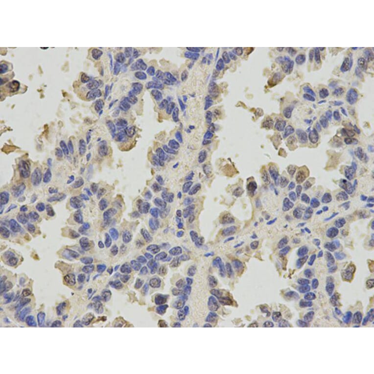 Immunohistochemistry - SLC4A4 Antibody from Signalway Antibody (32777) - Antibodies.com
