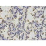Immunohistochemistry - SLC4A4 Antibody from Signalway Antibody (32777) - Antibodies.com