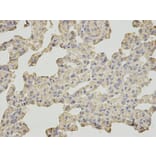 Immunohistochemistry - SLC4A4 Antibody from Signalway Antibody (32777) - Antibodies.com