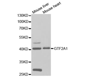 Western blot - GTF2A1 Antibody from Signalway Antibody (32786) - Antibodies.com