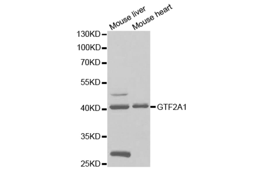 Western blot - GTF2A1 Antibody from Signalway Antibody (32786) - Antibodies.com