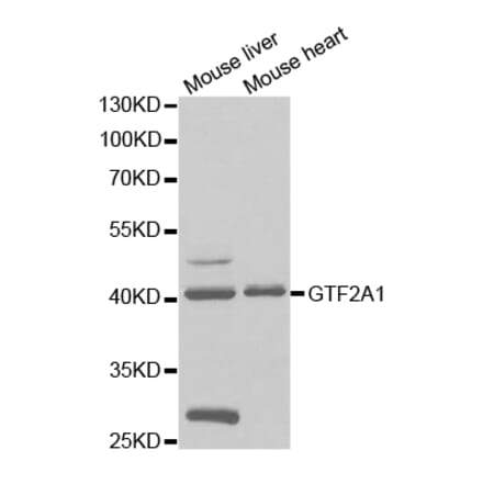 Western blot - GTF2A1 Antibody from Signalway Antibody (32786) - Antibodies.com
