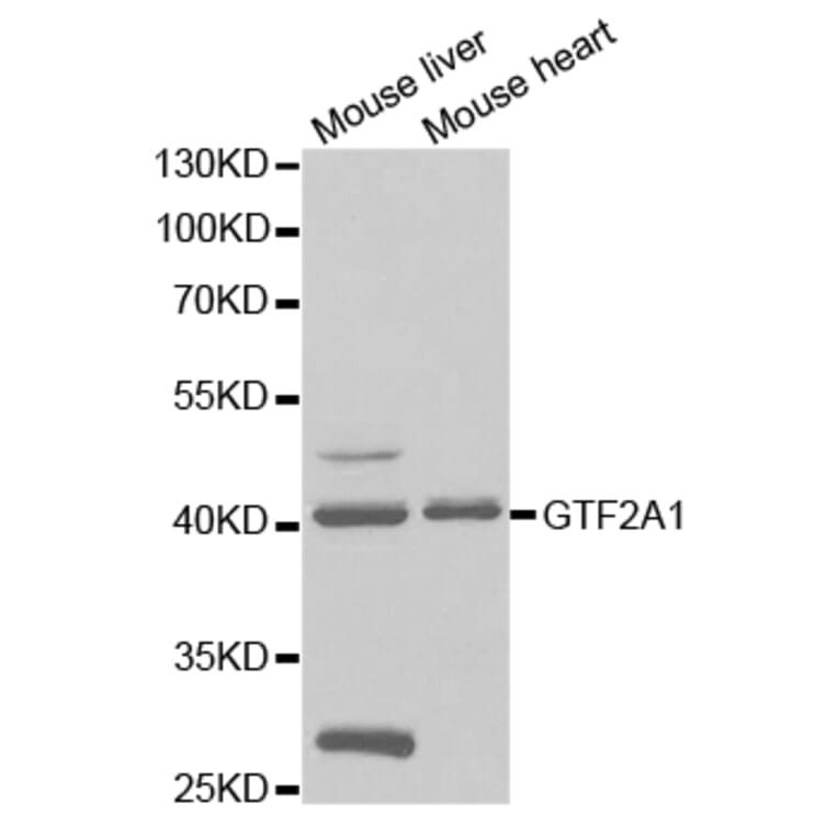 Western blot - GTF2A1 Antibody from Signalway Antibody (32786) - Antibodies.com