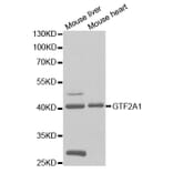 Western blot - GTF2A1 Antibody from Signalway Antibody (32786) - Antibodies.com