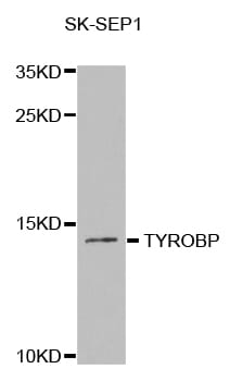 Western blot analysis of extracts of SK-SEP1 cell line, using TYROBP antibody.