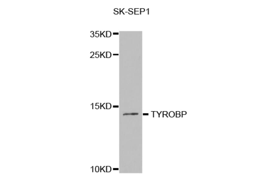 Western blot - TYROBP Antibody from Signalway Antibody (32819) - Antibodies.com