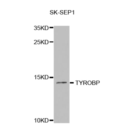 Western blot - TYROBP Antibody from Signalway Antibody (32819) - Antibodies.com