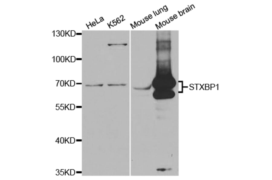 Western blot - STXBP1 Antibody from Signalway Antibody (32845) - Antibodies.com