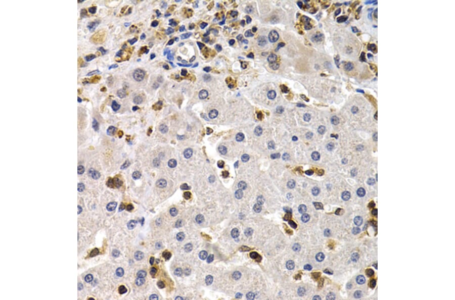 Immunohistochemistry - BCL11A Antibody from Signalway Antibody (32852) - Antibodies.com