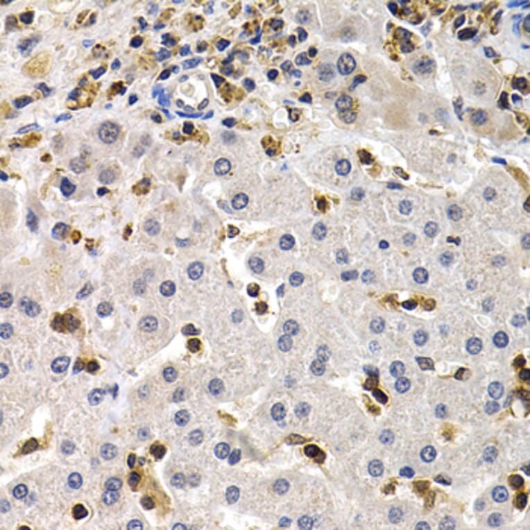 Immunohistochemistry - BCL11A Antibody from Signalway Antibody (32852) - Antibodies.com