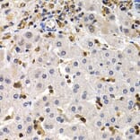 Immunohistochemistry - BCL11A Antibody from Signalway Antibody (32852) - Antibodies.com