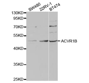 Western blot - ACVR1B Antibody from Signalway Antibody (32857) - Antibodies.com