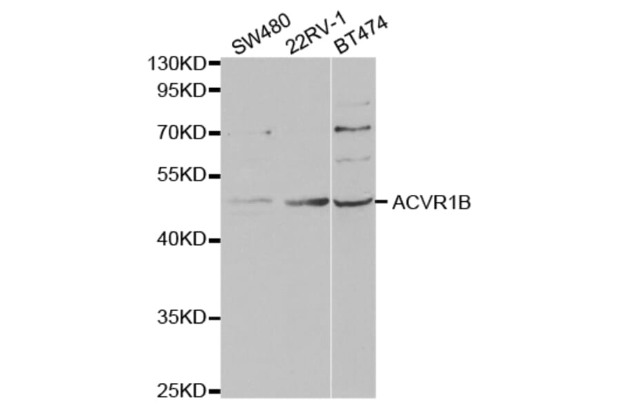 Western blot - ACVR1B Antibody from Signalway Antibody (32857) - Antibodies.com