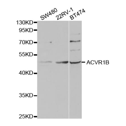 Western blot - ACVR1B Antibody from Signalway Antibody (32857) - Antibodies.com