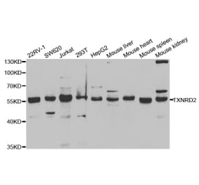 Western blot - TXNRD2 Antibody from Signalway Antibody (32885) - Antibodies.com