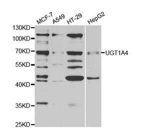 Western blot - UGT1A4 Antibody from Signalway Antibody (32901) - Antibodies.com