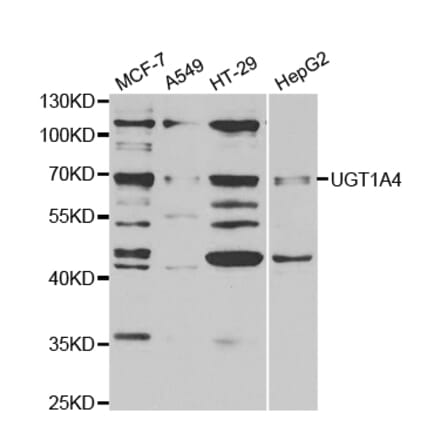 Western blot - UGT1A4 Antibody from Signalway Antibody (32901) - Antibodies.com