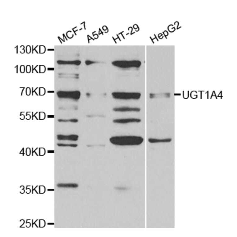 Western blot - UGT1A4 Antibody from Signalway Antibody (32901) - Antibodies.com