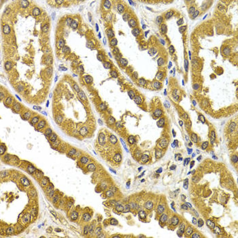 Immunohistochemistry - UGT1A4 Antibody from Signalway Antibody (32901) - Antibodies.com