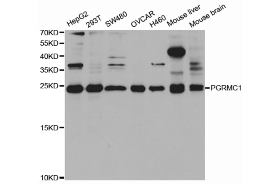 Western blot - PGRMC1 Antibody from Signalway Antibody (32927) - Antibodies.com