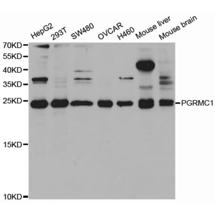 Western blot - PGRMC1 Antibody from Signalway Antibody (32927) - Antibodies.com