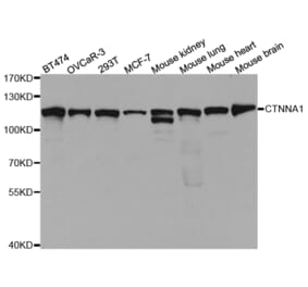 Western blot - CTNNA1 Antibody from Signalway Antibody (32937) - Antibodies.com