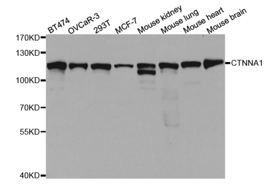 Western blot - CTNNA1 Antibody from Signalway Antibody (32937) - Antibodies.com