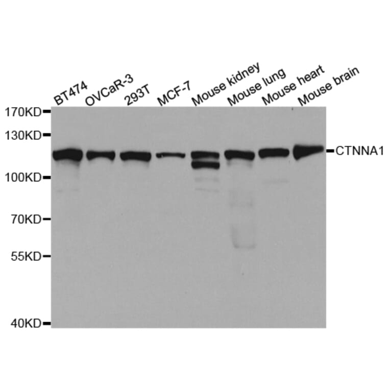 Western blot - CTNNA1 Antibody from Signalway Antibody (32937) - Antibodies.com