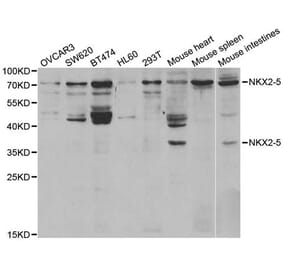 Western blot - NKX2-5 Antibody from Signalway Antibody (32949) - Antibodies.com