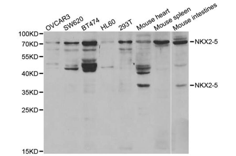 Western blot - NKX2-5 Antibody from Signalway Antibody (32949) - Antibodies.com