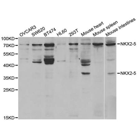 Western blot - NKX2-5 Antibody from Signalway Antibody (32949) - Antibodies.com