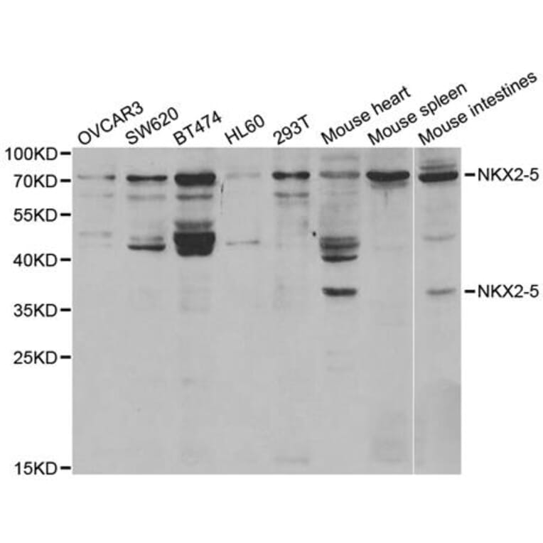 Western blot - NKX2-5 Antibody from Signalway Antibody (32949) - Antibodies.com