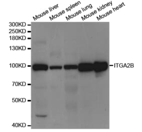 Western blot - ITGA2B Antibody from Signalway Antibody (32970) - Antibodies.com