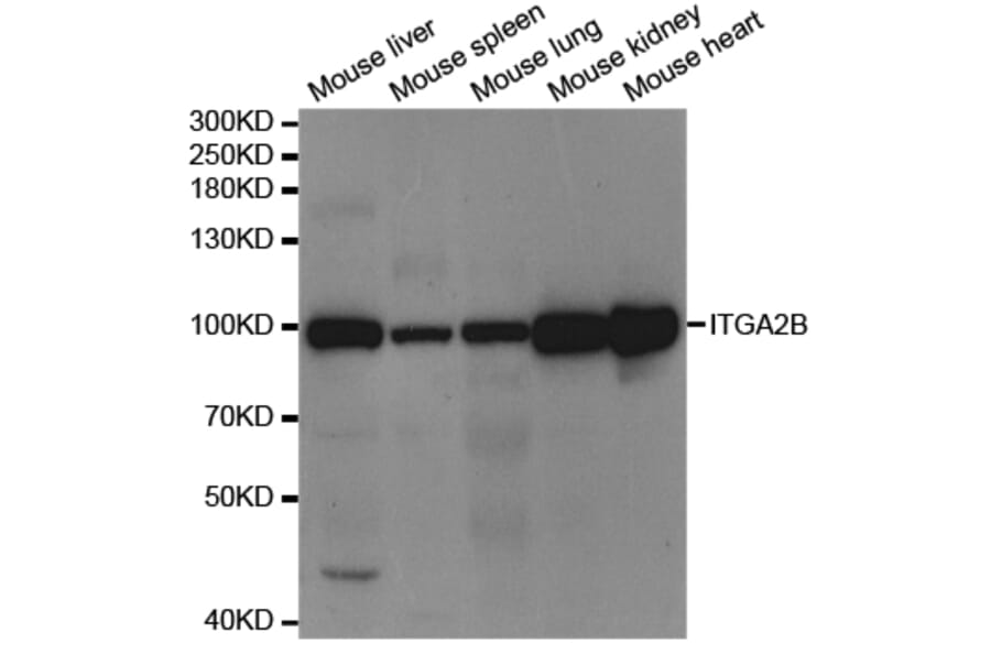 Western blot - ITGA2B Antibody from Signalway Antibody (32970) - Antibodies.com